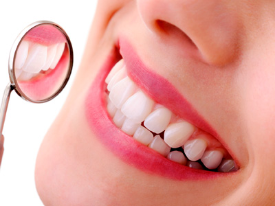 Clareamento Dental - Tatuapé